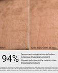Sérum anti-taches G.M. Collin, avant et après sur les taches brunes, à Blainville