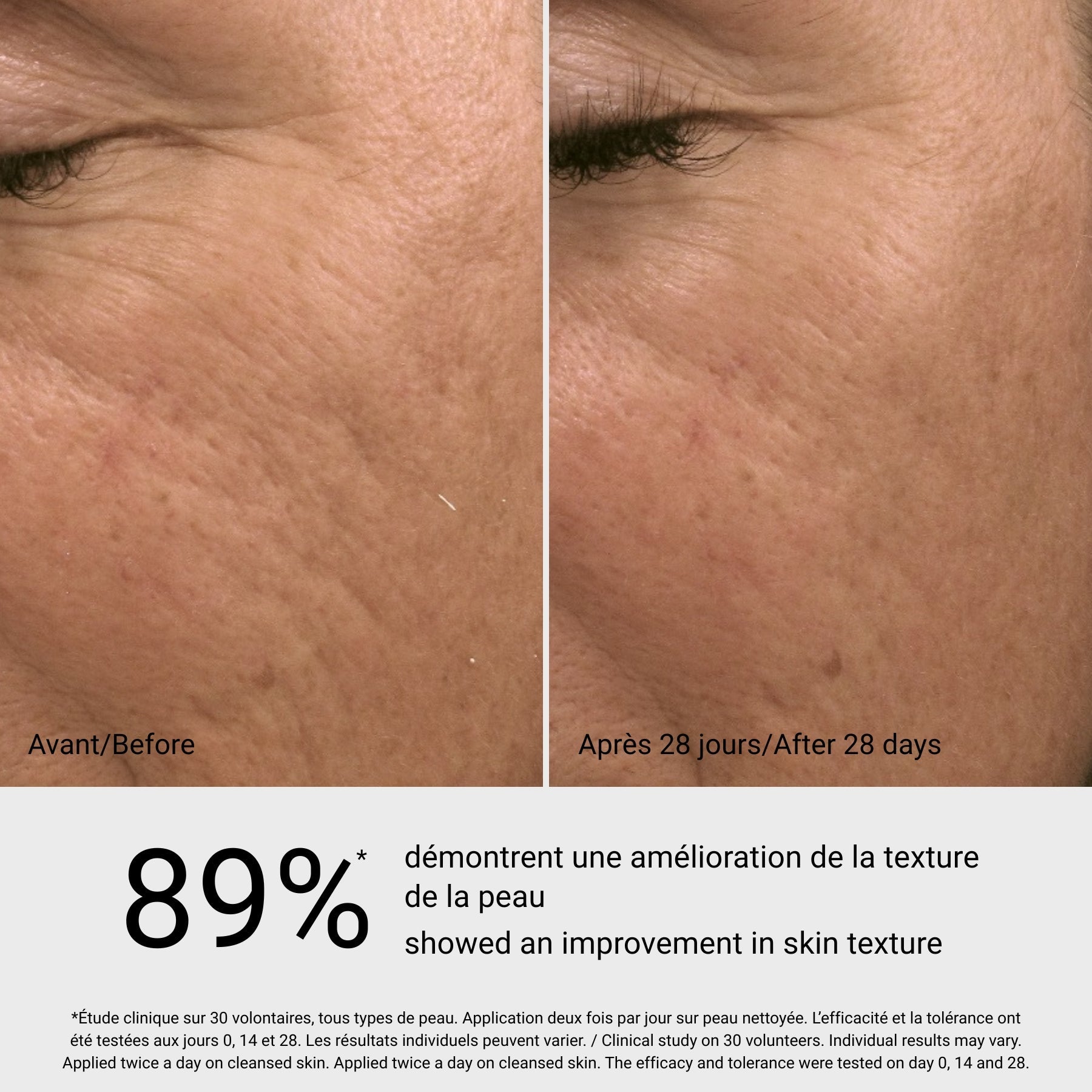 Peel Toner Exfoliant G.M. Collin, avant et après sur le grain de peau, à Blainville