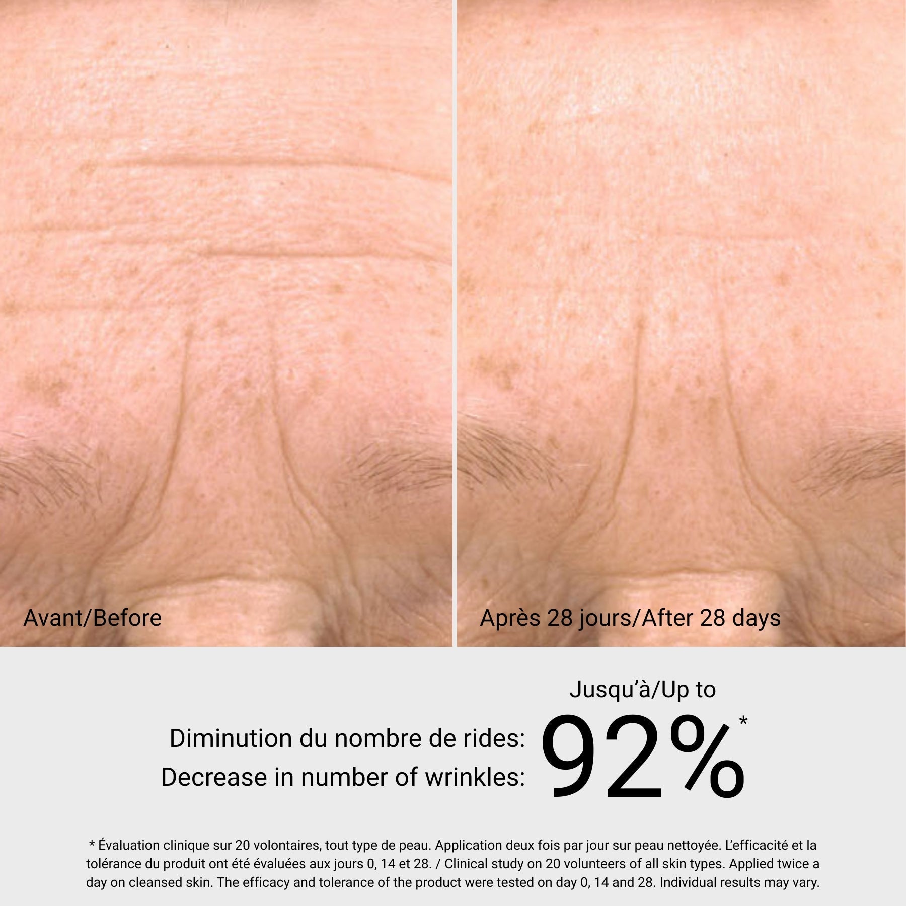 Phyto Stem Cell Sérum G.M. Collin, avant et après, à Blainville